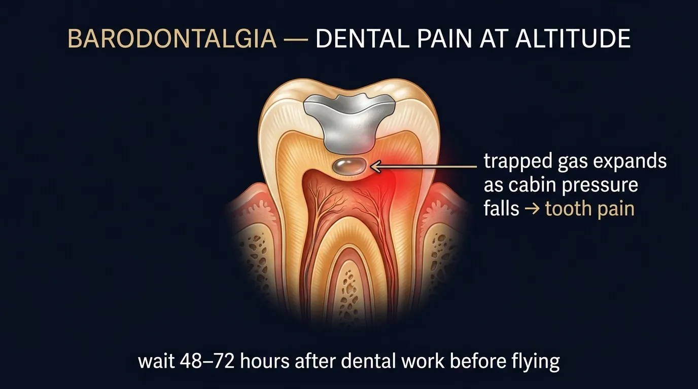 Barodontalgia — dental pain at altitude