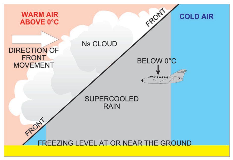 A warm front with warm air above 0 C, rain falling through freezing air below and a freezing level near the ground.